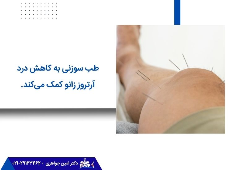 طب سوزنی برای زانودرد