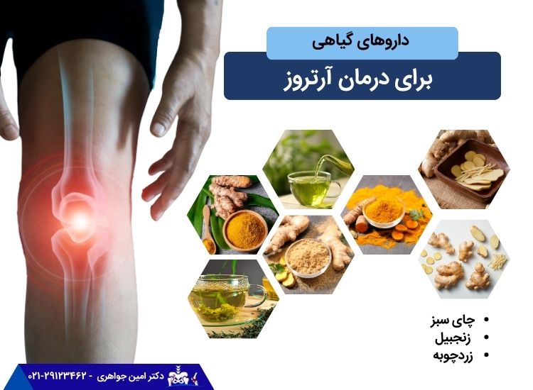 گیاهان دارویی برای درمان آرتروز