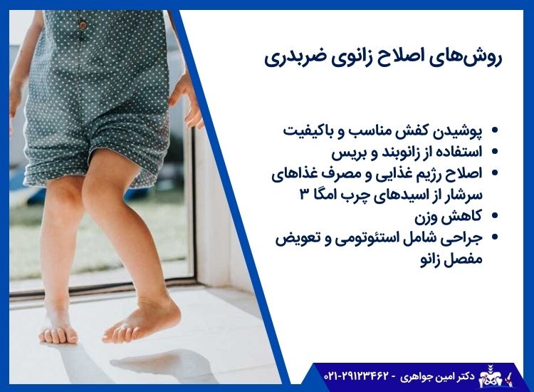 درمان زانوی ضربدری