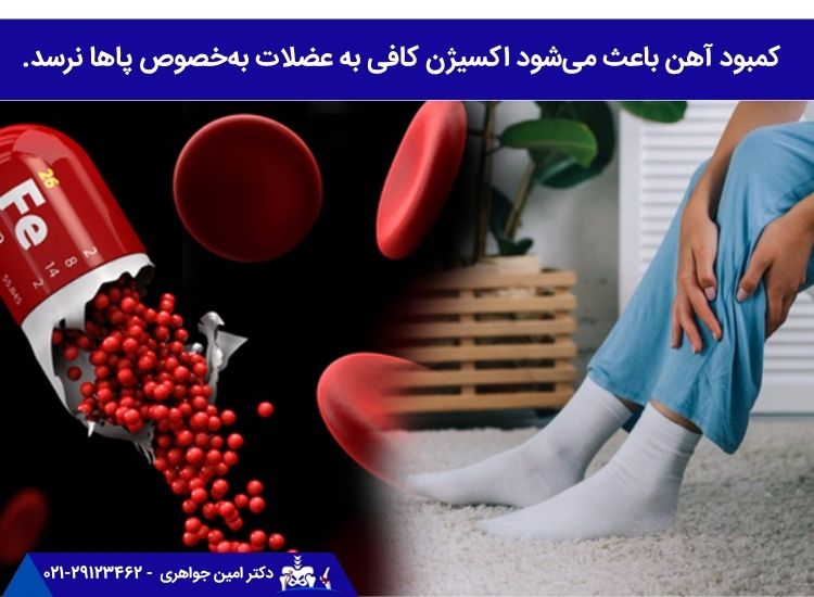 کمبود آهن و ضعف پا