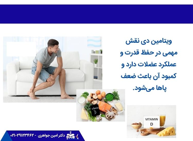 کمبود ویتامین دی و ضعف پا