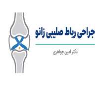 عمل جراحی رباط صلیبی زانو | چه زمانی لازم است، مراحل عمل و دوره بهبودی