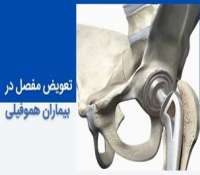 تعویض مفصل زانو و لگن در بیماران هموفیلی - مشکلات جراحی