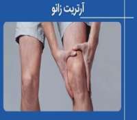 آرتریت زانو چیست و  چطور درمان می شود؟