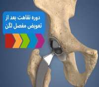 مدت استراحت بعد از عمل تعویض مفصل لگن چجقدر است؟