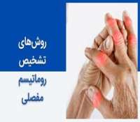 انواع آزمایش های مورد نیاز برای تشخیص روماتیسم مفصلی