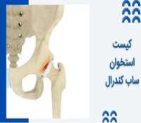 کیست‌ استخوان ساب‌ کندرال (SBCs) چیست و چطور درمان می شود؟