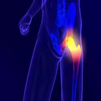 درد لگن و مفصل ران - راه‌های درمان
