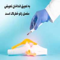 خطرات به تعویق انداختن جراحی تعویض مفصل زانو