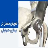 تعویض مفصل زانو و لگن در بیماران هموفیلی - مشکلات جراحی