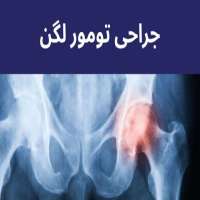 جراحی تومور لگن