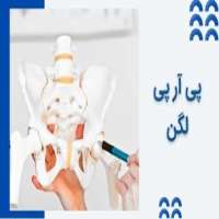 میزان اثربخشی پی‌ آر پی لگن برای درمان آرتروز لگن