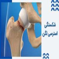 شکستگی استرسی لگن چیست  و چطور درمان می شود؟
