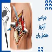 جراحی آرتروز مفصل ران