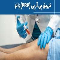 پی آر پی (PRP) زانو چیست و چقدر تاثیر دارد؟