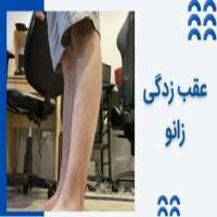 عقب زدگی زانو چیست و چطور درمان می شود؟