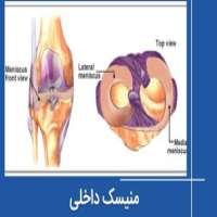 منیسک داخلی - آناتومی کامل