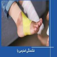 شکستگی استرسی پا چیست و چطور درمان می شود؟
