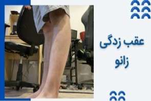 عقب ‌زدگی زانو چیست و چطور درمان می شود؟