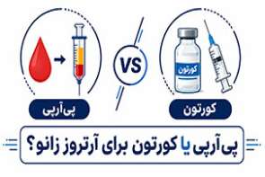 مقایسه پی‌آرپی و کورتیزون در درمان آرتروز زانو | کدام گزینه مناسب شماست؟
