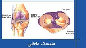 منیسک داخلی - آناتومی کامل