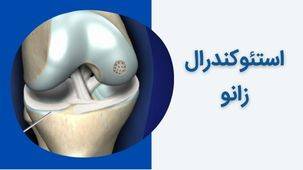 استئوکندرال زانو چیست و چطور درمان می شود؟