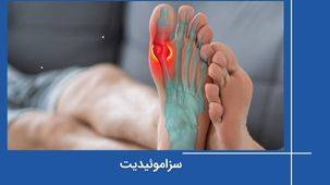 سزاموئیدیت یا التهاب استخوان سزاموئید چیست؟