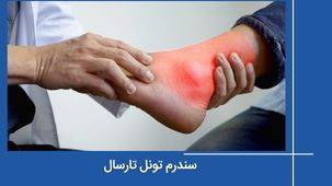 سندرم تونل تارسال چیست و چرا باید آن را جدی گرفت؟