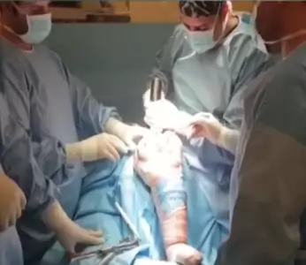 فیلم عمل جراحی تعویض مفصل زانو