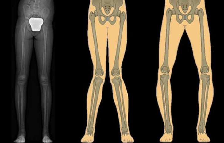 تفاوت پای پرانتزی و زانوی ضربدری چیست؟ راهنمای کامل