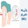 پارگی رباط داخلی زانو (MCL) - روش های تشخیص و درمان