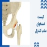 کیست‌ استخوان ساب‌ کندرال (SBCs) چیست و چطور درمان می شود؟
